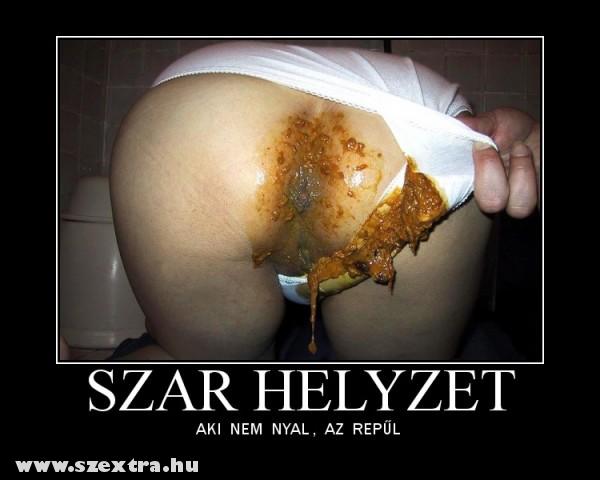 Szar helyzet