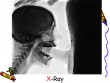 Az orális szex röntgen képe